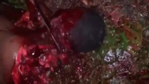 Photograph session of a cut scalp 1 Photograph session of a cut scalp