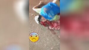 The motorcyclist's cranium ruptured and also his brains leaked 1 The motorcyclist's cranium ruptured and also his brains leaked