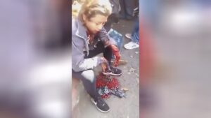 The palm relaxes only on the tendone