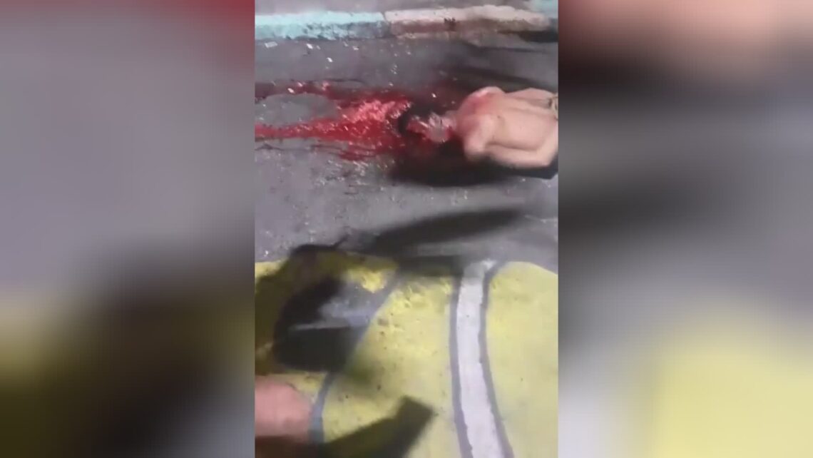 This is what an individual scalp appears like after being actually hit