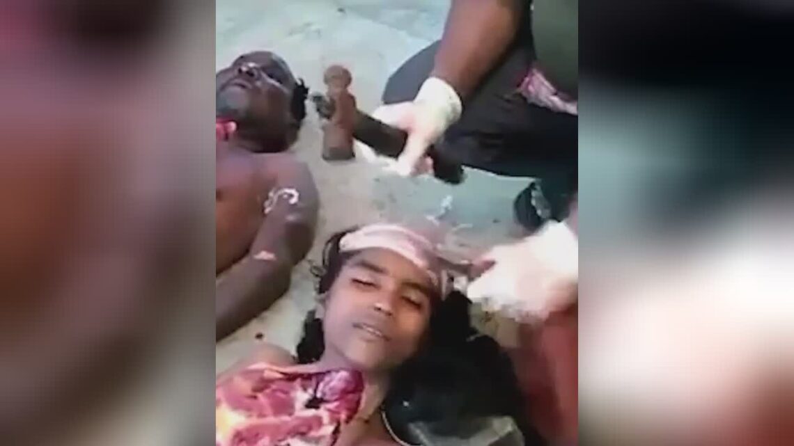 Trepanation of the skull of the stone age