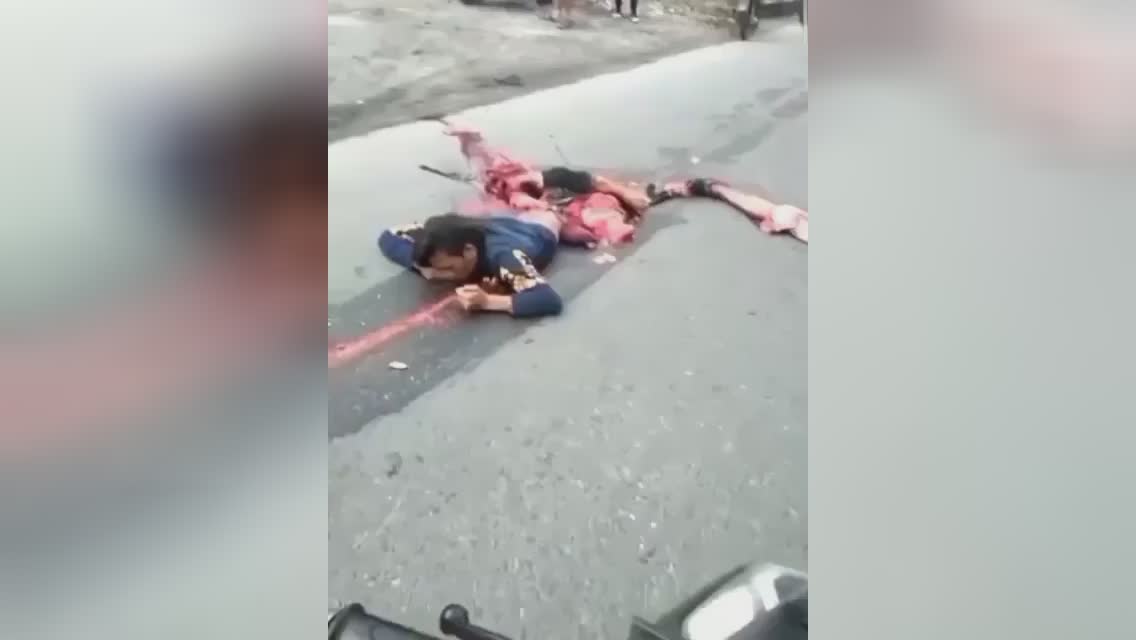 Two dead in an incident, one physical body torn in fifty percent