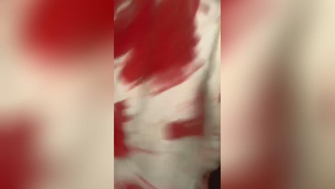 When living is the worse choice