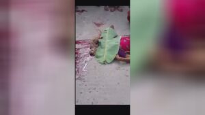  Woman's head popped away from her skin layer in an incident india