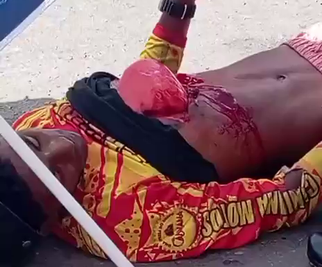 A Dude Hit By A Car Demonstrates The Functioning Of A Human Lung