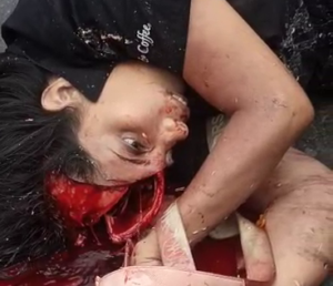 Two Women Died While Crossing The Road