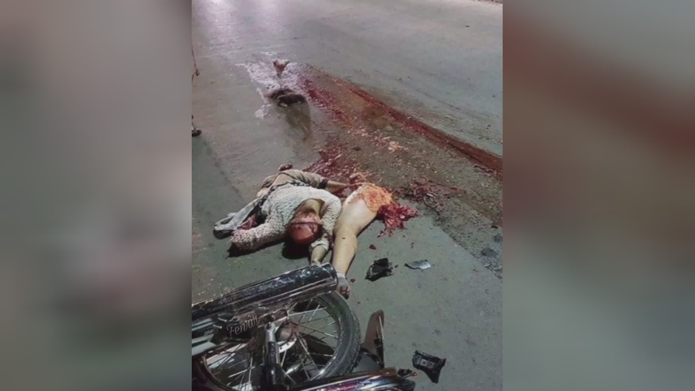 A twenty years outdated lady crushed by a truck