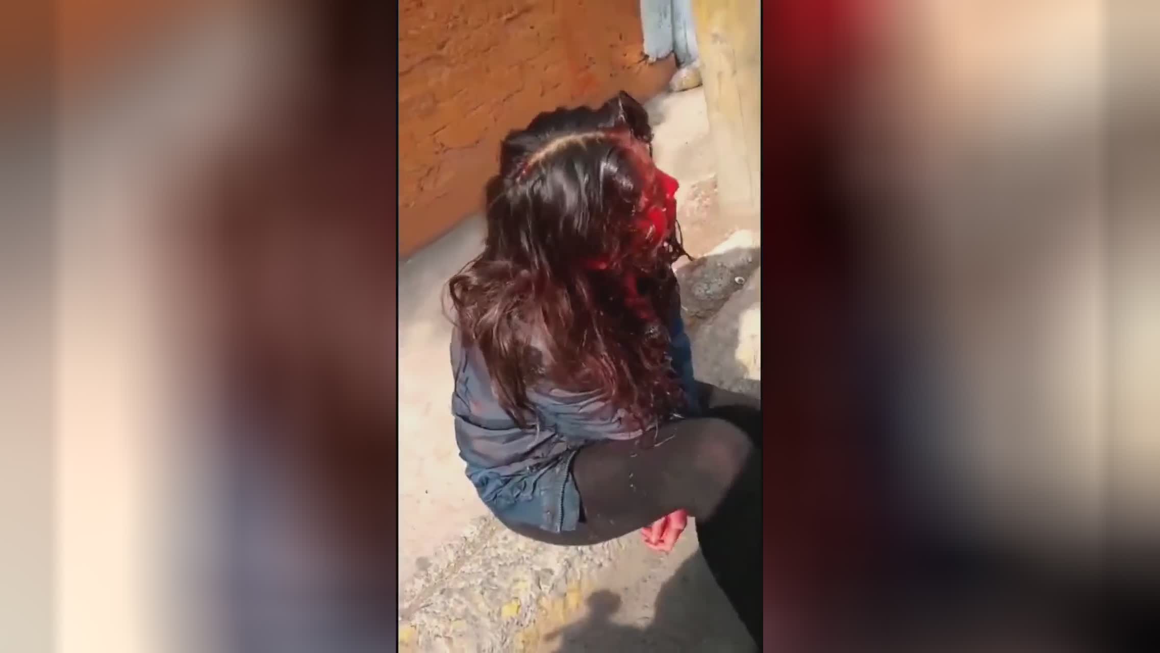 A lady slowly vanishes from life after being actually plunged