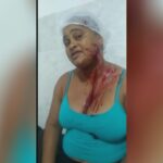 Prepare cut along with knife in the skin