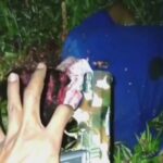 Guy completely mutilated through machete