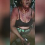 Girl in surprise after husband slit her throat along with a pointy knife