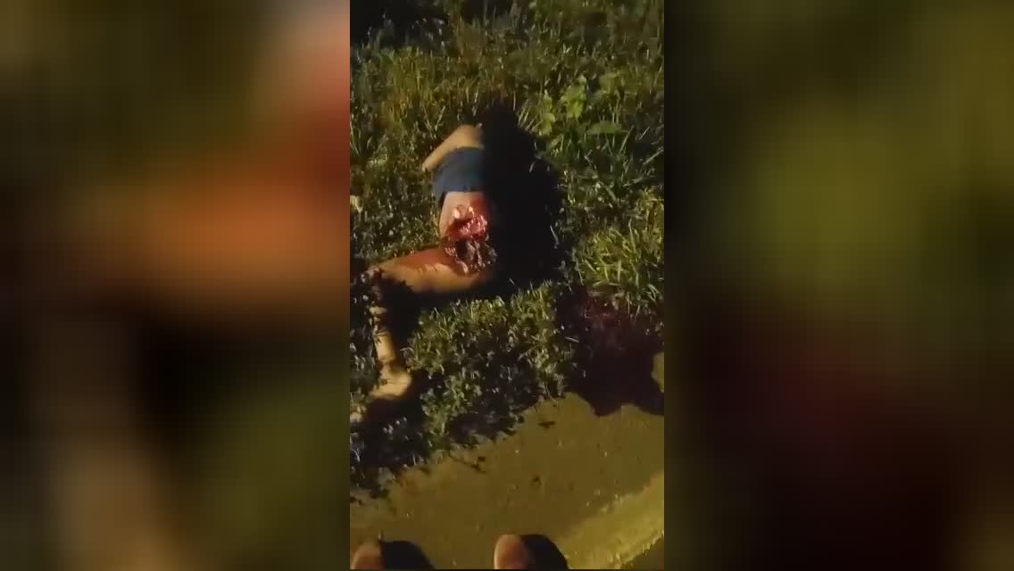 Female possesses her lower leg severed in incident