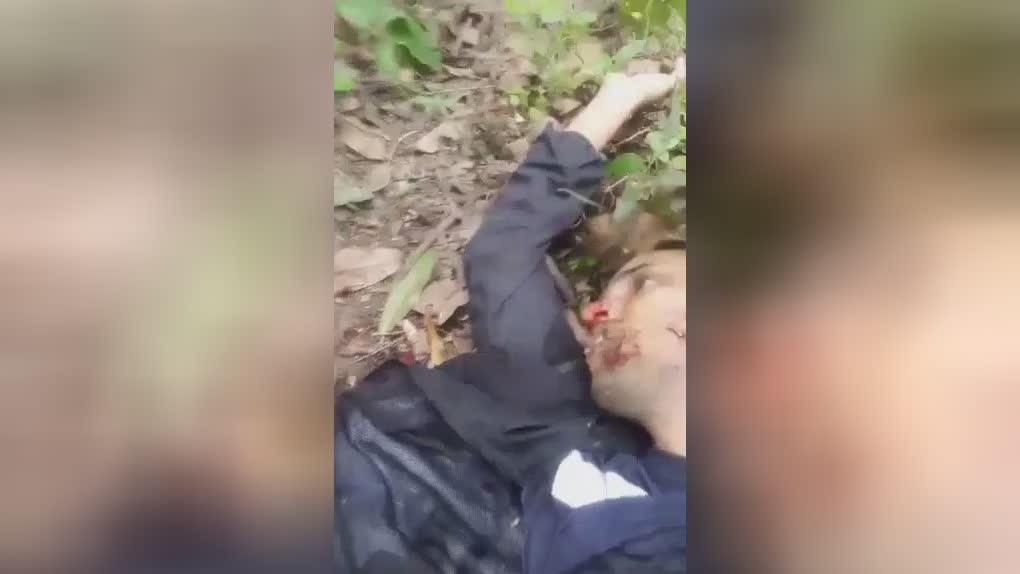 wounds in the face and gouges out the eye