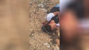 Blood stream water fountain from the back and also shots to the skin 1 Blood stream water fountain from the back and also shots to the skin