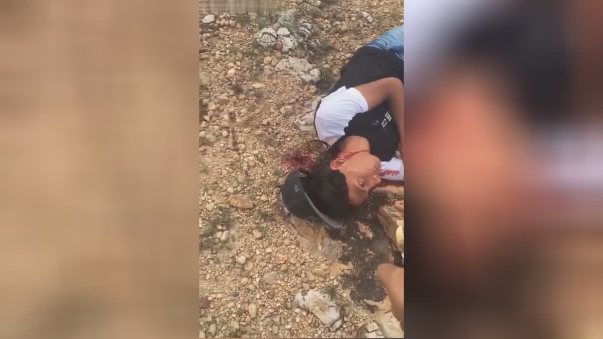 Blood stream water fountain from the back and also shots to the skin