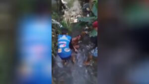 Broke hands along with a wood club 1 Broke hands along with a wood club