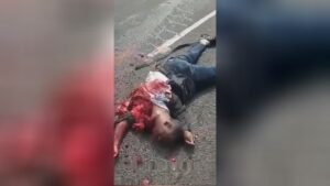 The soul of a guy mutilated in a mishap remains to bea