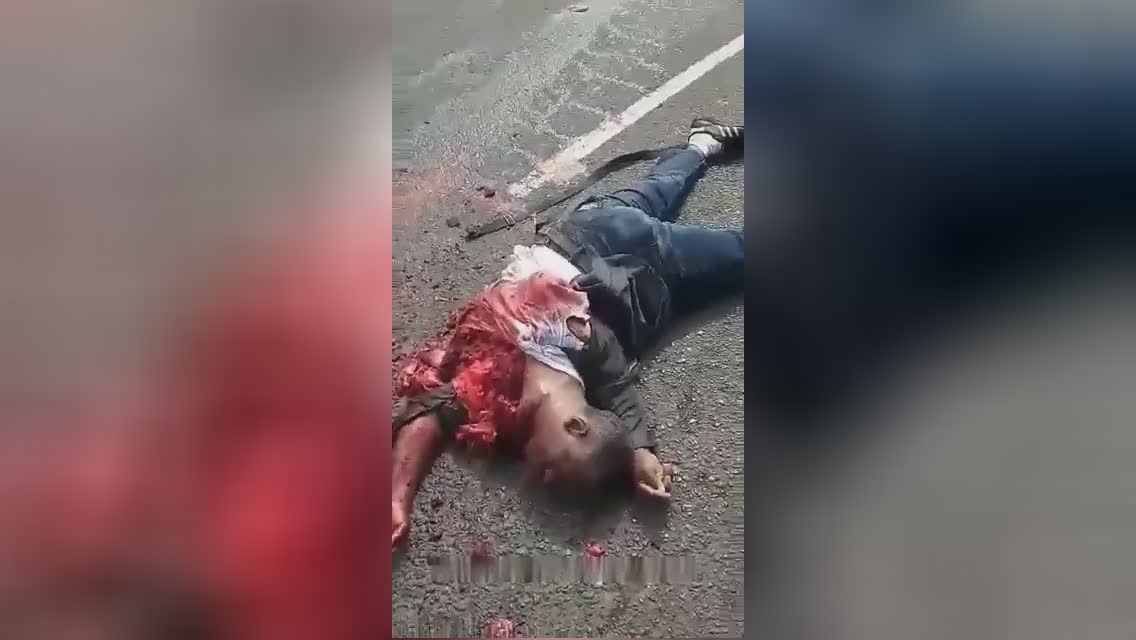 The soul of a guy mutilated in a mishap remains to bea