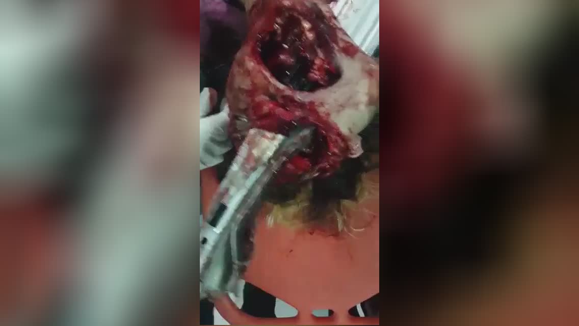 The man’s cranium was actually fully mutilated by a metal pole