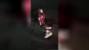 The end result of a horrendous mishap - a guy's leg and upper arm was actually cut 1 The end result of a horrendous mishap - a guy's leg and upper arm was actually cut