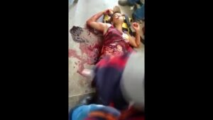 The woman's guts fell out