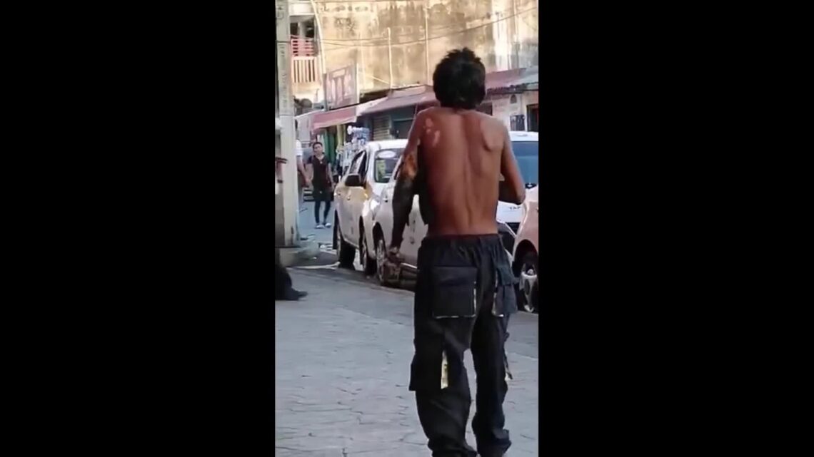 Zombie walk of electrocution survivor