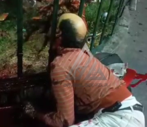 The Attackers Literally Hammered The Man's Head Between The Bars Of The Fence