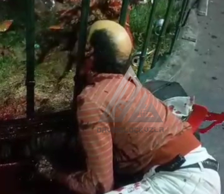 The Attackers Literally Hammered The Man’s Head Between The Bars Of The Fence