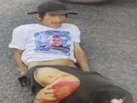 Damn Dude….That Leg Is Fucked