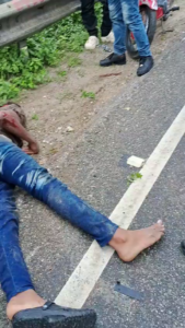 A Motorcyclist Crashed Into A Road Barrier, Lost Part Of His Scalp And Died