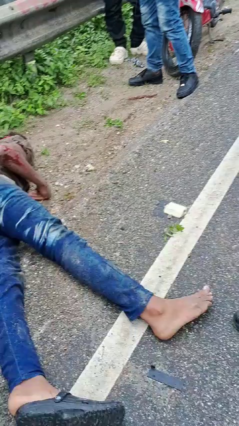 A Motorcyclist Crashed Into A Road Barrier, Lost Part Of His Scalp And Died