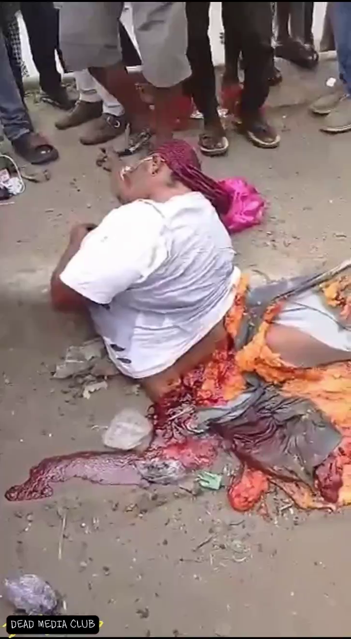 Graphic Video Shows A Woman Ripped In Half On The Street