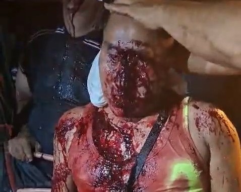 Dude Got That Agonal Breathing Going On