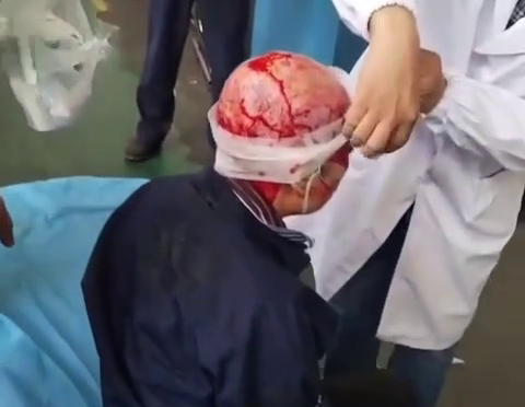 Woman Got Scalped At Factory