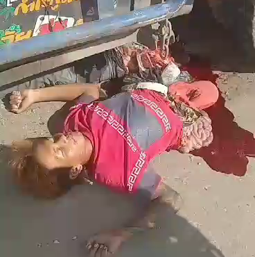 Biker Left With His Guts Exposed