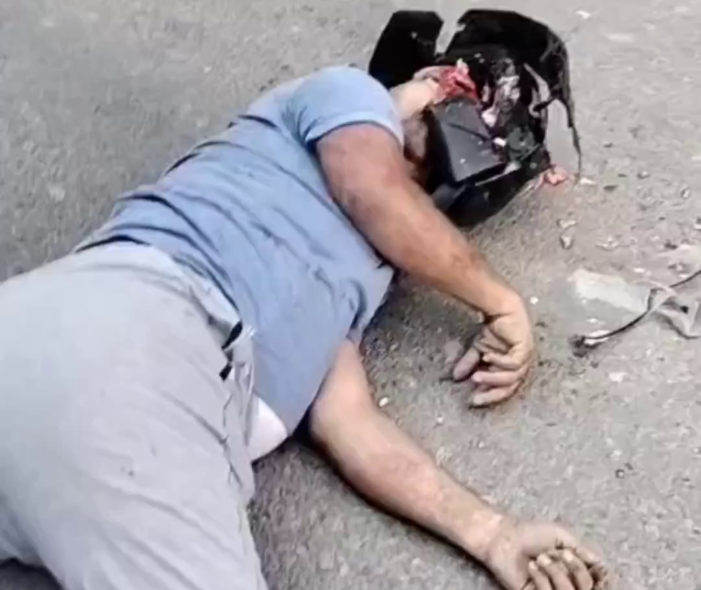 His Helmet Didn’t Help