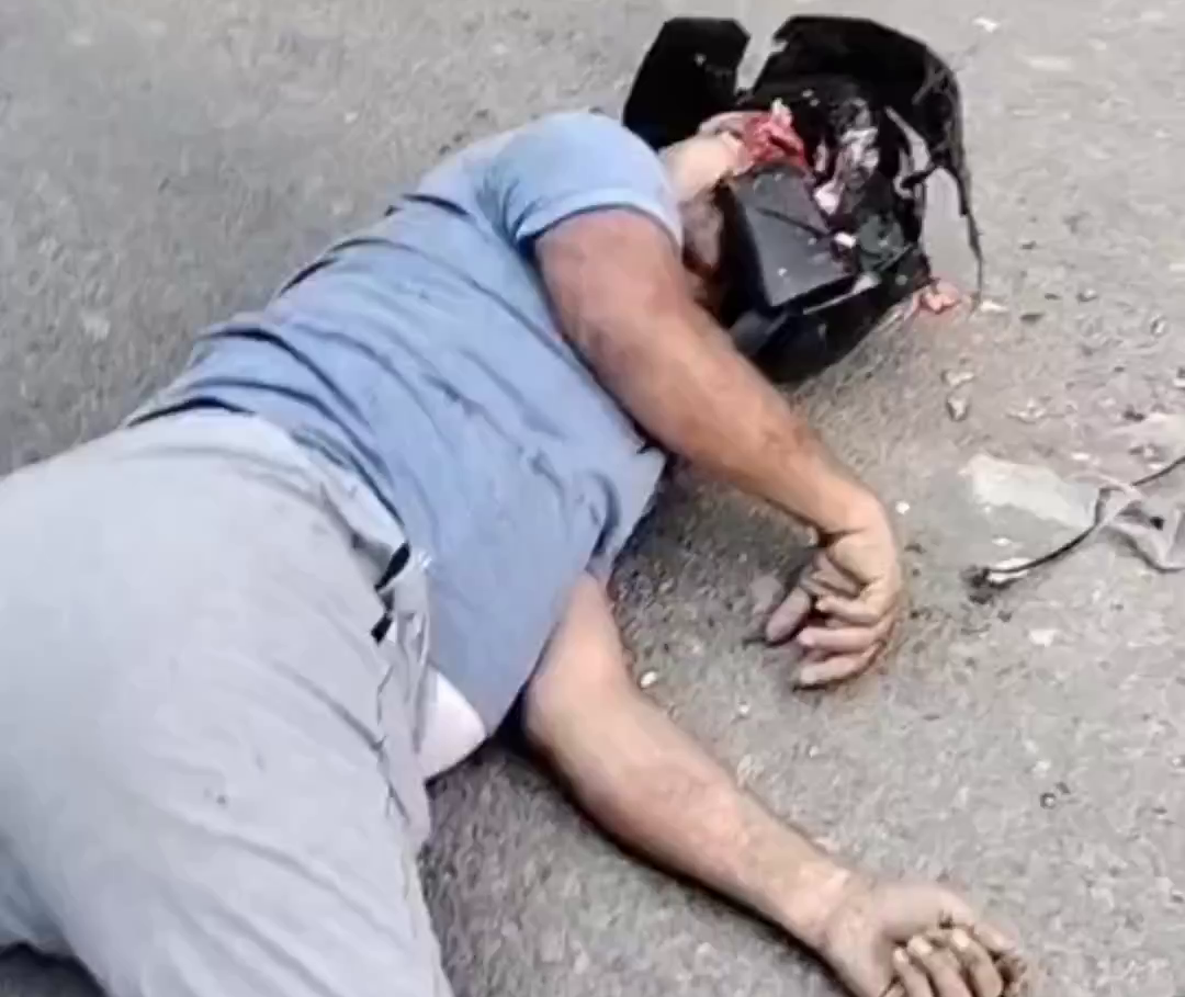 His Helmet Didn’t Help