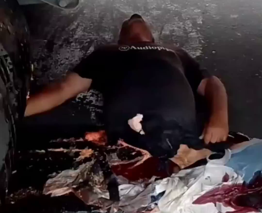 Biker Got Fucked Up By Truck