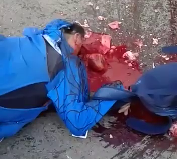 The Big And Probably Kind Heart Of A Motorcyclist Continues To Beat While Lying On The Road