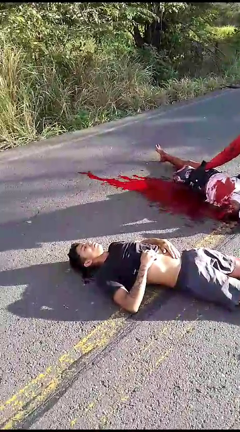 As A Result Of The Collision, One Motorcyclist Lost An Arm And A Leg