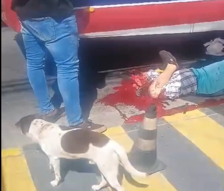 As A Result Of The Accident, The Man’s Foot Was Torn Off