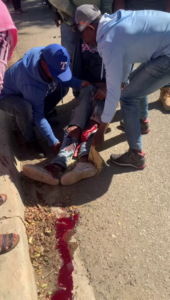 The 18 Year Old Motorcyclist Lost His Leg As A Result Of A Collision With Toyota Hilux 22-R