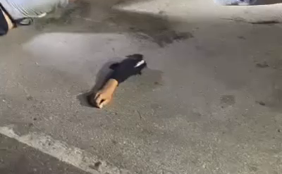 Two Young People Received Severe Injuries While Driving On Motorcycles, One Of Them Lost His Hands