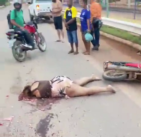 A Woman’s Skull Was Fractured As A Result Of A Motorcycle Hitting A Road Barrier