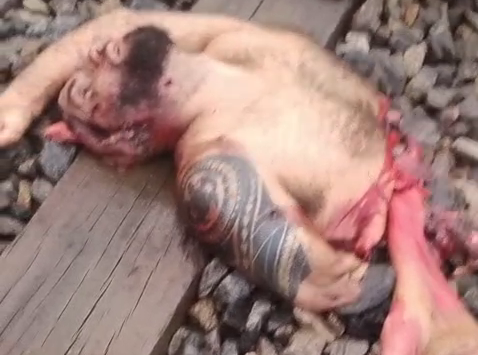 Half Of A Bearded Man Hit By A Train