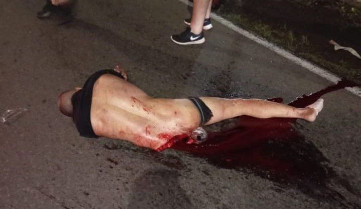 A Man And A Woman In A Car Died After Crashing Into A Pole. Costa Rica