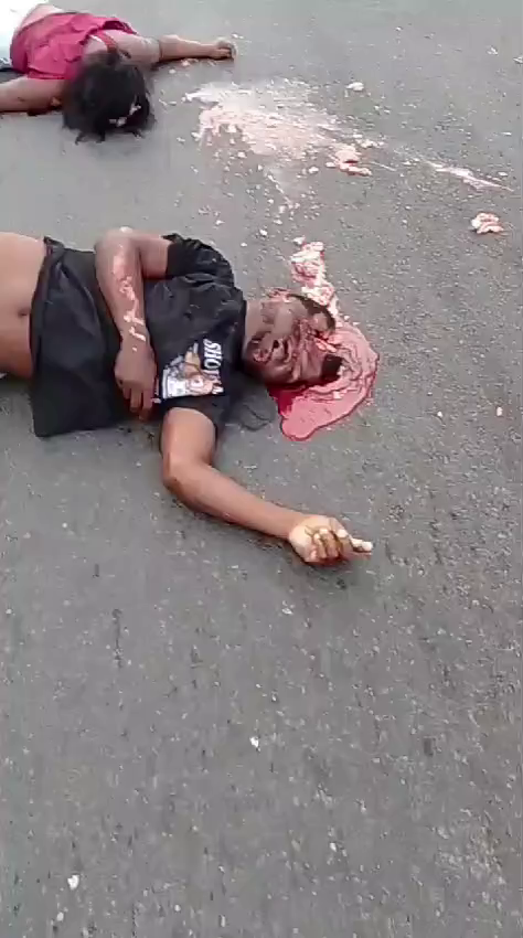 A Man And A Woman Died In A Road Accident, A Man Burst A Skull