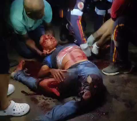 As A Result Of The Accident, The Guy Has Both Legs Broken