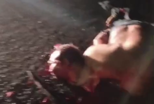 Body Parts Of A Motorcyclist In An Accident Are Scattered On The Road