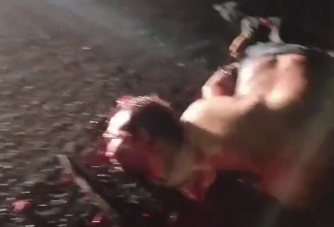 Body Parts Of A Motorcyclist In An Accident Are Scattered On The Road